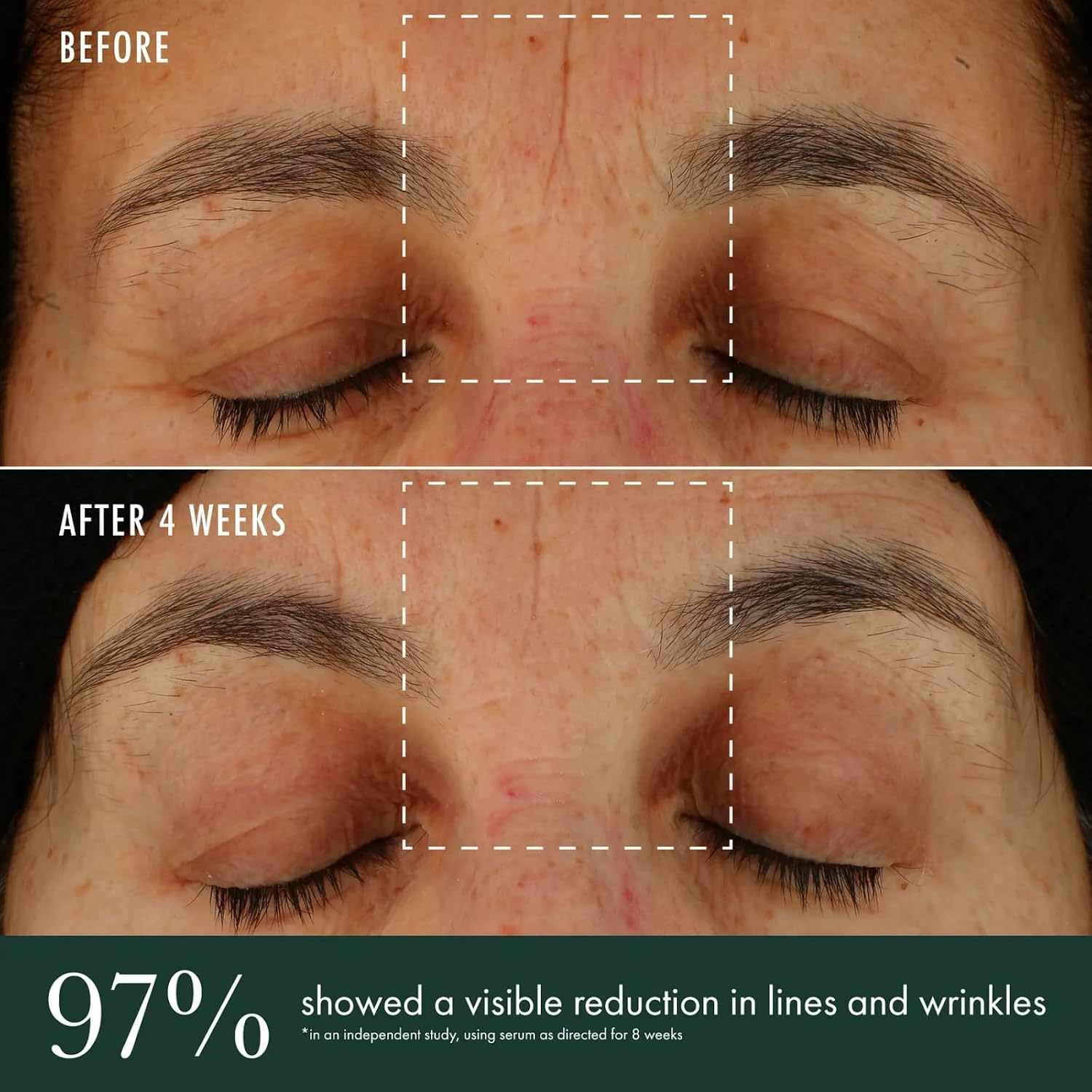 【RéVive】Brightening Serum 淨白光采抗老精華液 (維他命C/菸鹼醯胺/生物新生活膚胜肽/均勻膚色/細緻肌膚/1 fl oz)